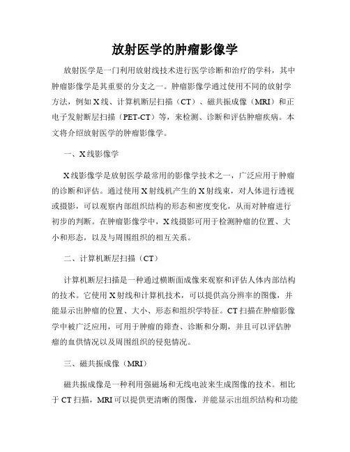 放射医学的肿瘤影像学