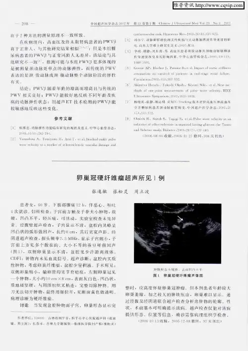卵巢冠硬纤维瘤超声所见1例