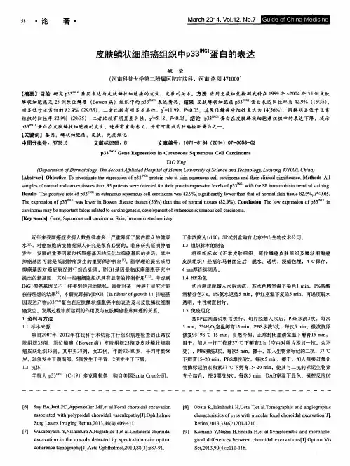 皮肤鳞状细胞癌组织中p33ING1蛋白的表达