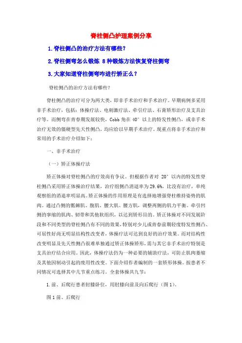 脊柱侧凸护理案例分享