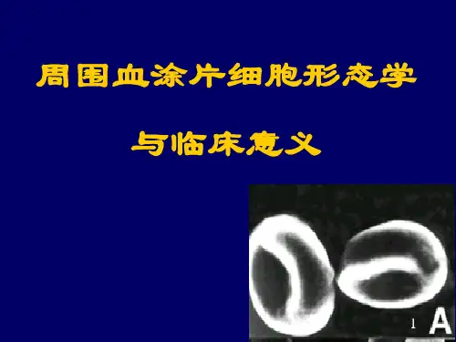 周围血涂片形态和临床意义