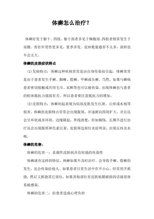 体癣怎么治疗？