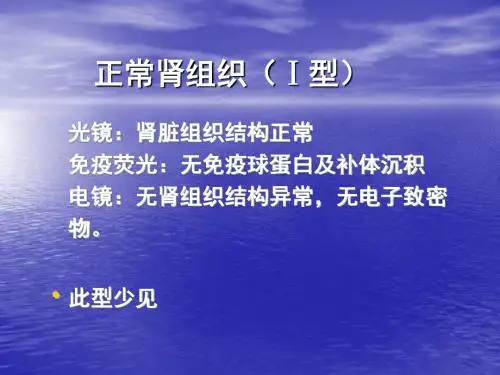 狼疮性肾炎的诊治PPT课件