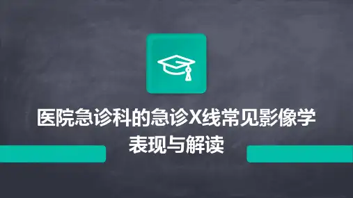医院急诊科的急诊X线常见影像学表现与解读