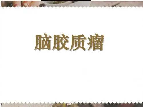 脑胶质瘤  ppt课件
