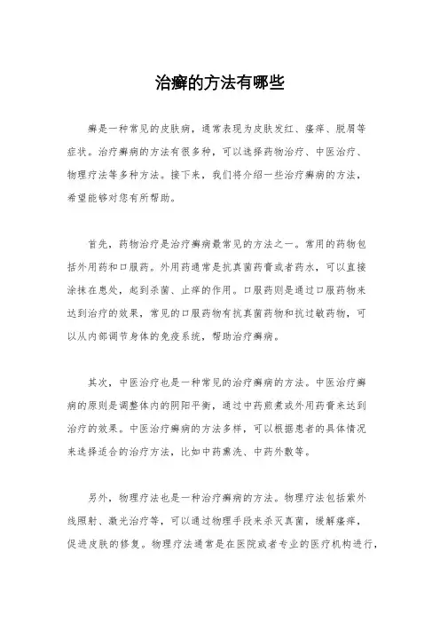 治癣的方法有哪些