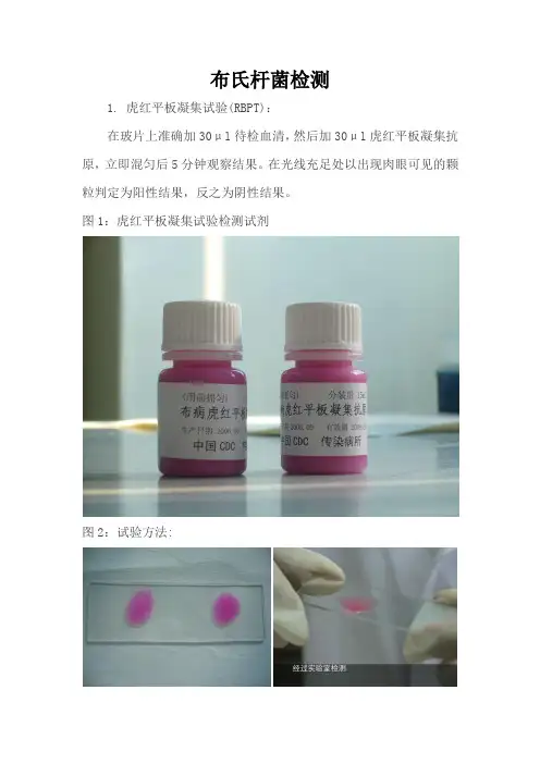 布氏杆菌试验检测步骤