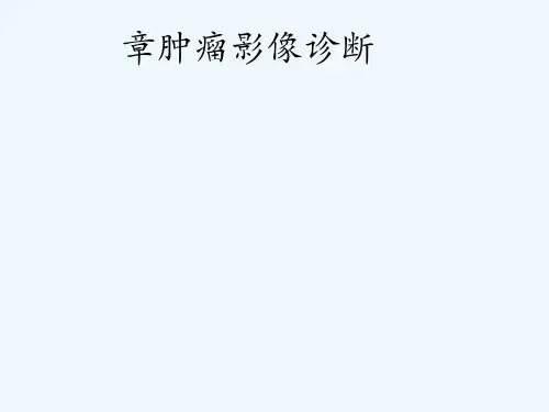 第十章 肿瘤影像诊断