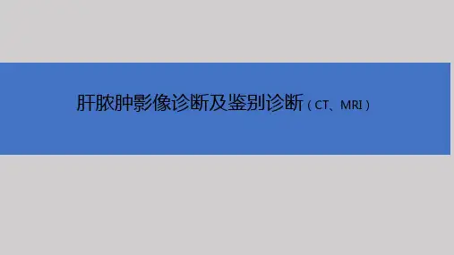 肝脓肿影像诊断及鉴别诊断ppt课件