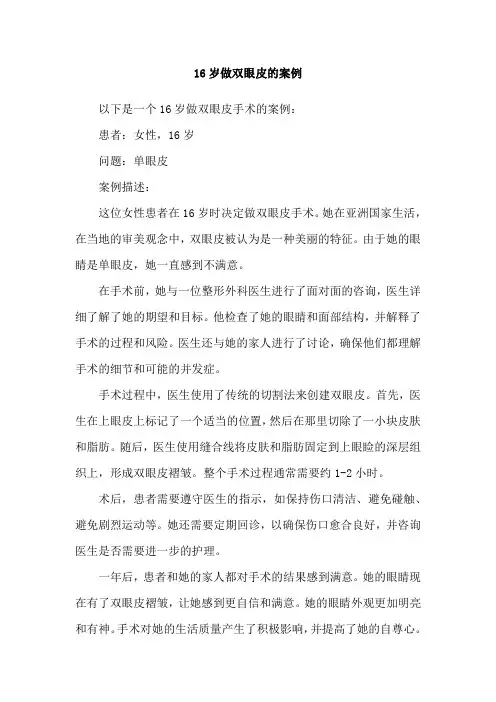 16岁做双眼皮的案例