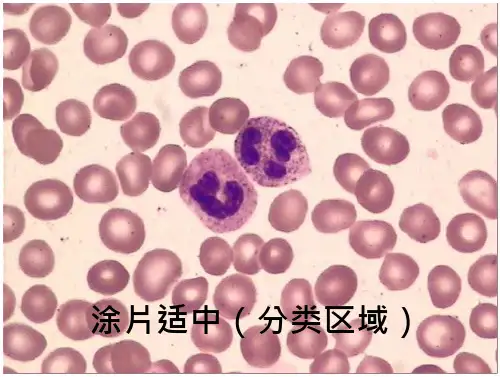 血细胞图谱大全