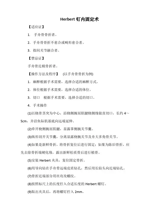 Herbert钉内固定术(标准版)