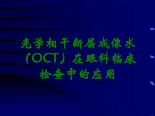 光学相干断层成像术(OCT)在眼科临床检查中的应用
