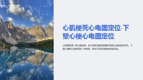 心肌梗死心电图定位-下壁心梗心电图定位