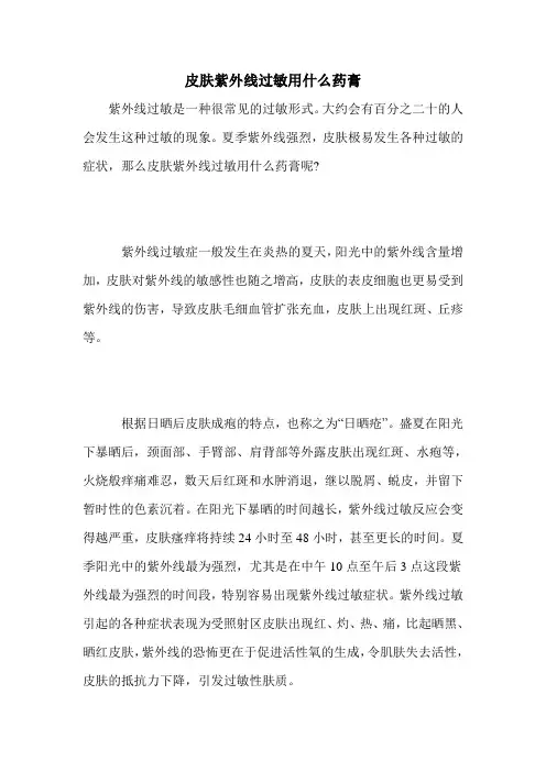 皮肤紫外线过敏用什么药膏