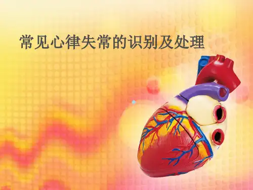 常见心律失常的识别及处理ppt课件