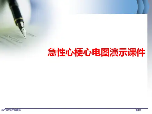 急性心梗心电图演示