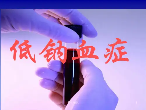 低钠血症培训[专业荟萃]