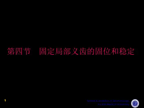 口腔修复 第四章 第四节 固定局部义齿的固位和稳定