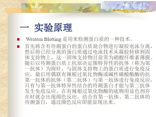 实验七蛋白质免疫印迹实验WesternBlotting