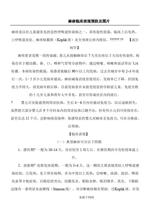 麻疹的表格模板现及图片