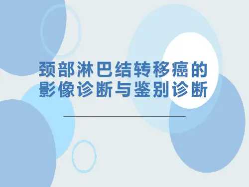 颈部淋巴结转移癌的影像诊断与鉴别诊断