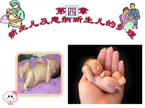 4章1-2节新生儿护理