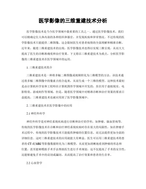 医学影像的三维重建技术分析