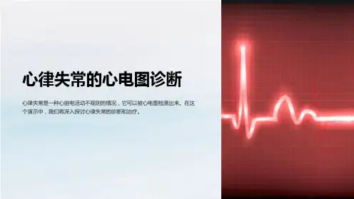心律失常的心电图诊断