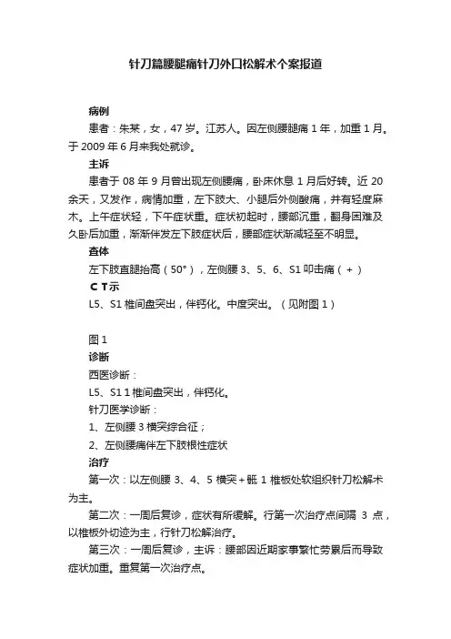 针刀篇腰腿痛针刀外口松解术个案报道