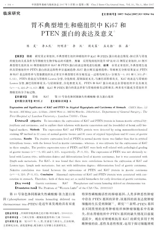 胃不典型增生和癌组织中Ki67和PTEN蛋白的表达及意义