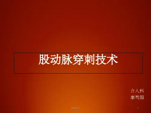 介入股动脉穿刺术ppt课件
