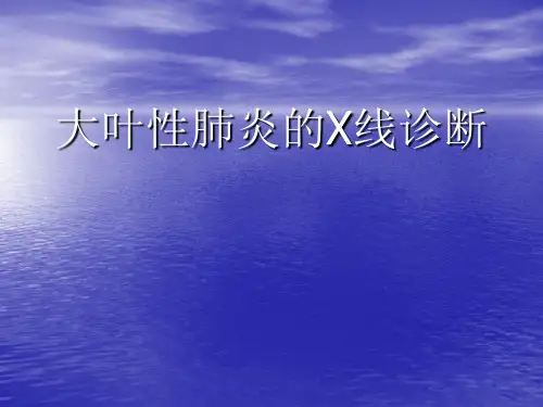 大叶性肺课件