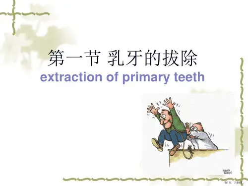 第10章 乳牙及年轻恒牙的拔除 178