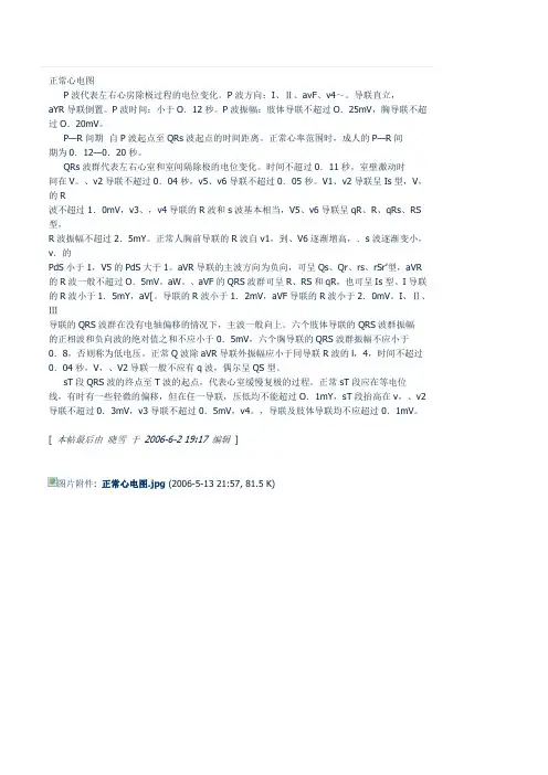 正常心电图