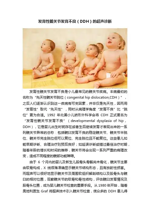 发育性髋关节发育不良（DDH）的超声诊断