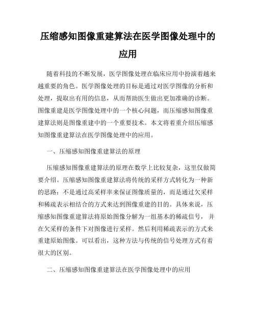 压缩感知图像重建算法在医学图像处理中的应用