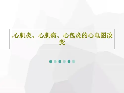 .心肌炎、心肌病、心包炎的心电图改变共48页