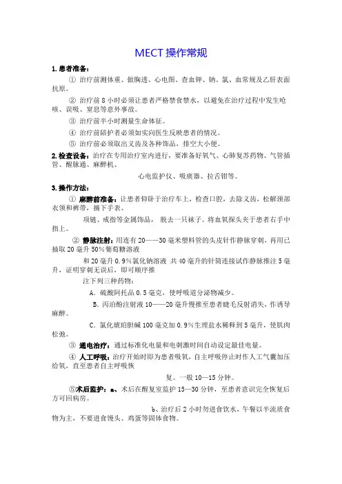 MECT操作常规