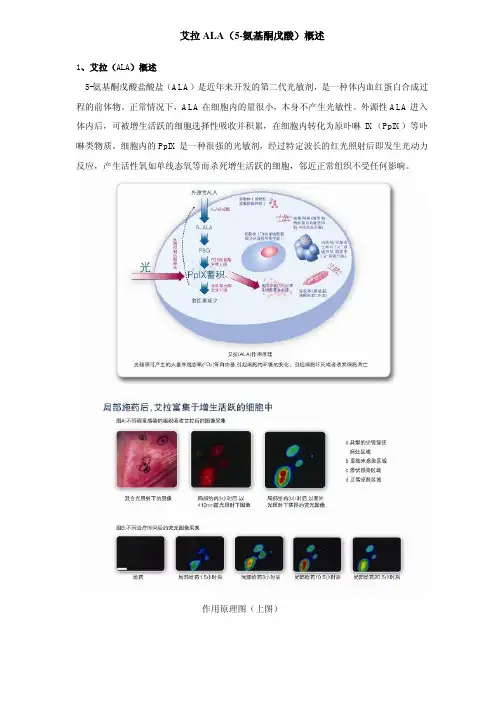 艾拉ALA(5-氨基酮戊酸)概述