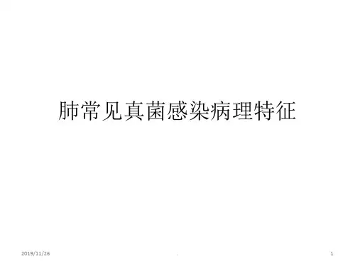 肺常见真菌感染病理特征PPT课件