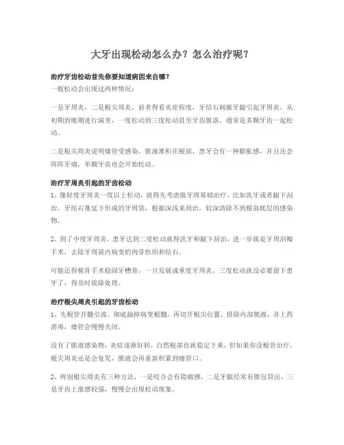 大牙出现松动怎么办？怎么治疗呢？