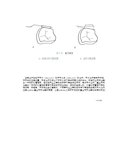 直丝弓矫治器