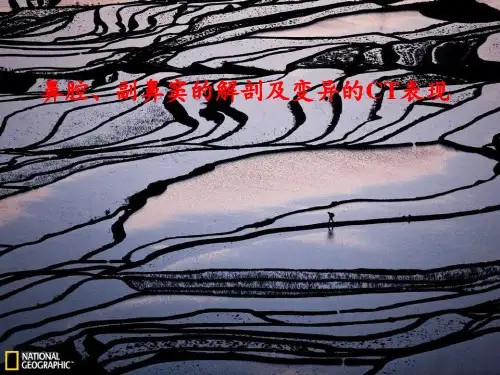 副鼻窦解剖学基础 ppt课件