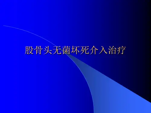 股骨头无菌坏死介入治疗(ANFH)