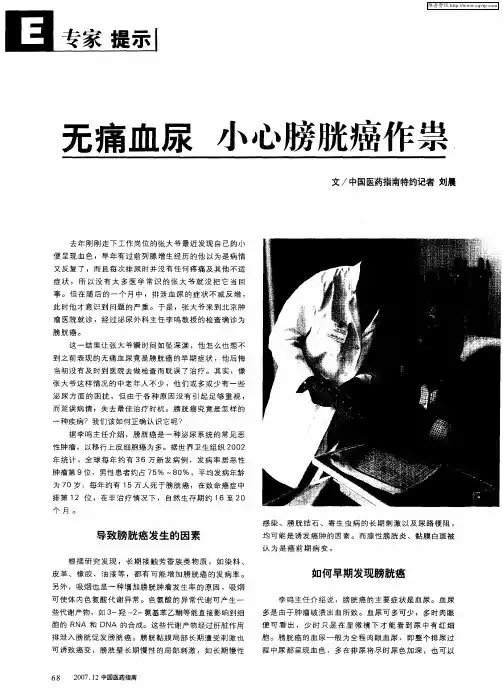 无痛血尿小心膀胱癌作祟