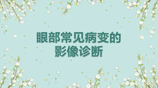 眼部常见病变的影像诊断