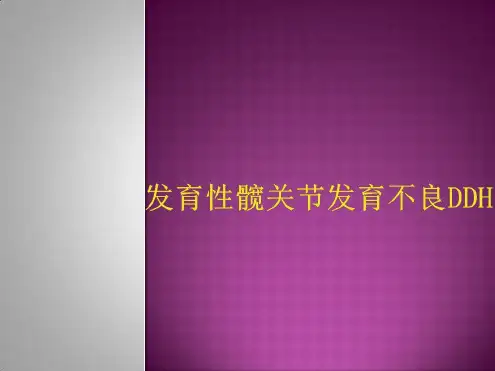 发育性髋关节发育不良DDH-2022年学习资料