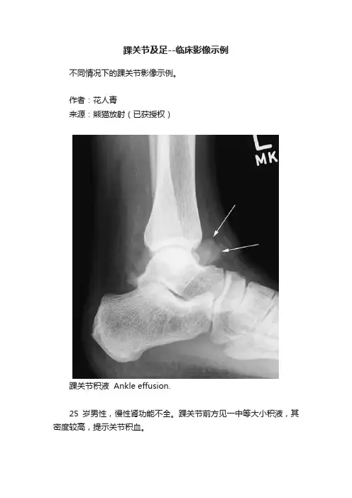 踝关节及足--临床影像示例