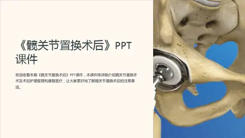 《髋关节置换术后》课件